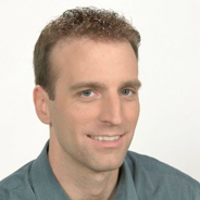 Hair Loss Replacement - After