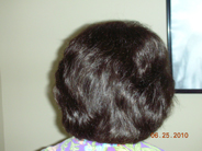 Women's Hair Loss Treatment - After Photo 2