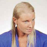 Women's Hair Loss Treatment - Before