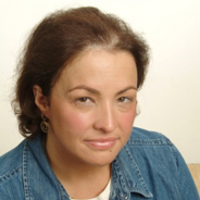 Female Hair Loss Treatment - Before